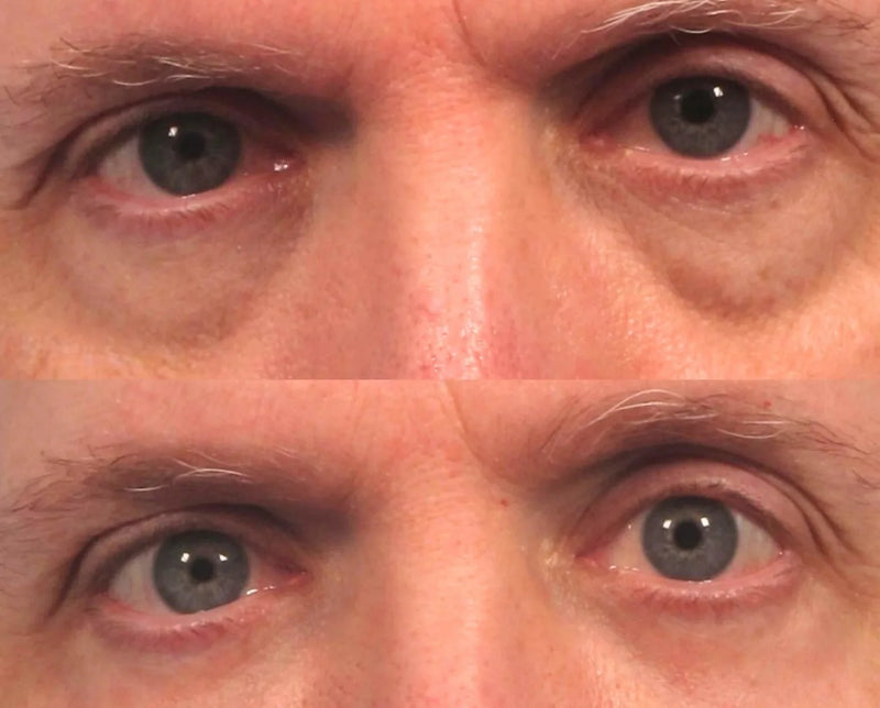 Before and after