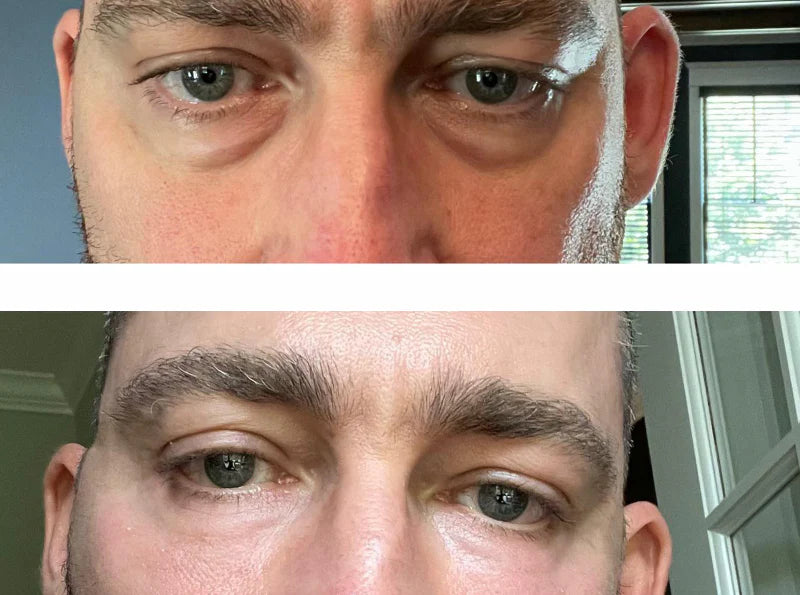 Before and after